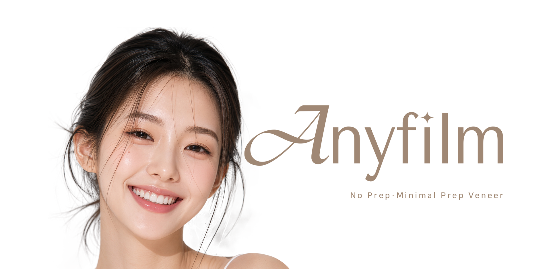 No Prep · Minimal Prep Veneer