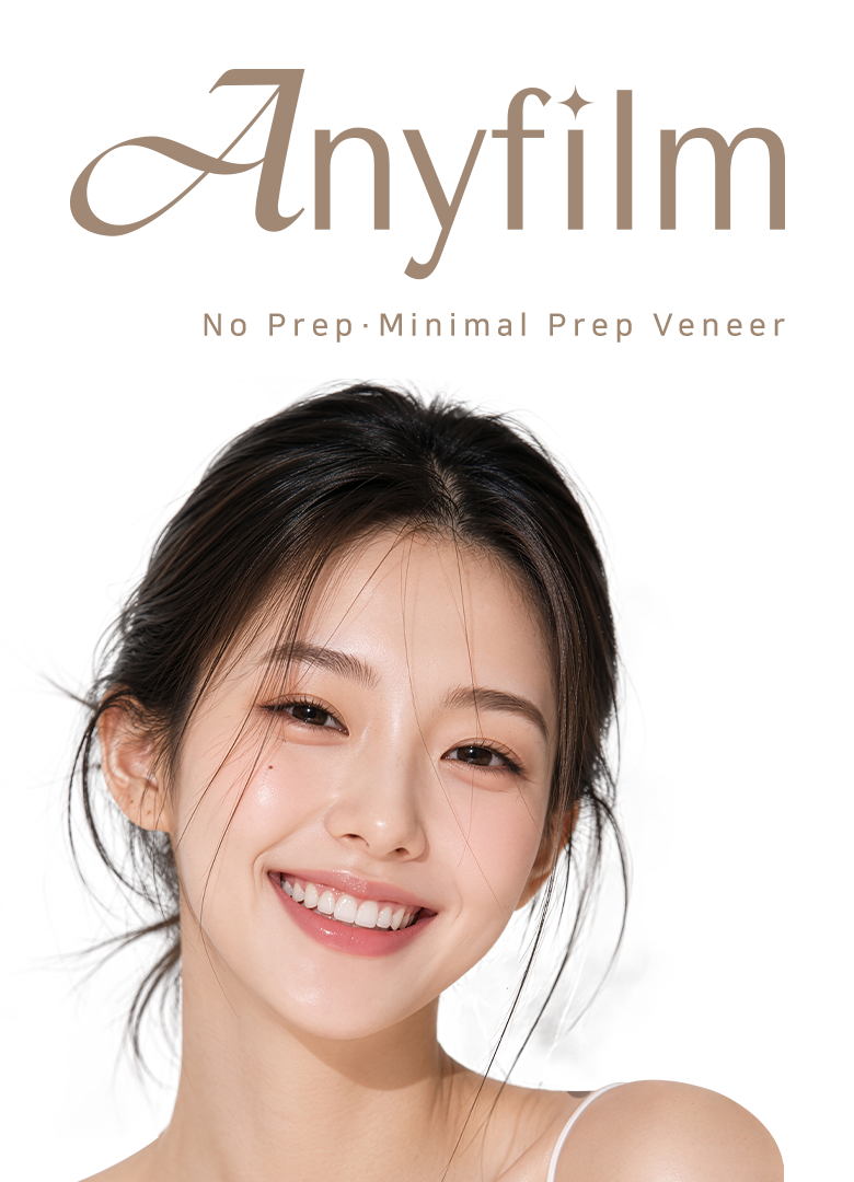 No Prep · Minimal Prep Veneer