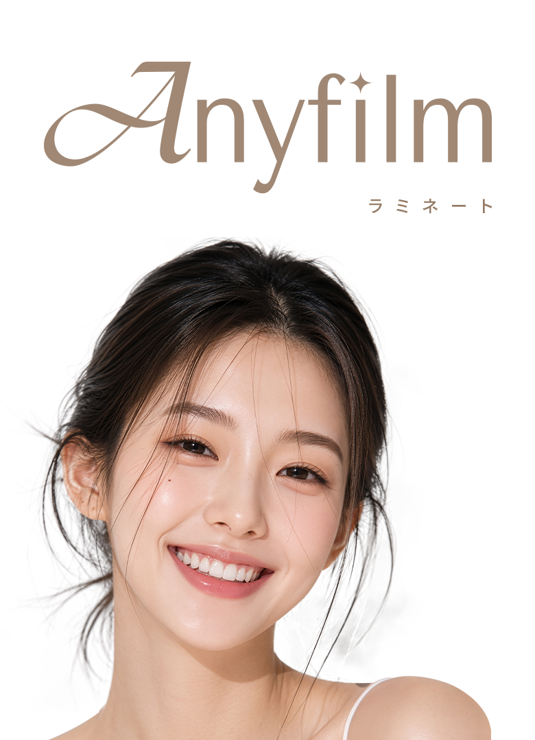 ラミネート